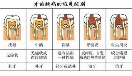 src=http___www.lovelytooth.com_uploads_allimg_191121_1-19112110362V12.jpg&refer=http___www.lovelytooth.jpg src=http___www.lovelytooth.com_uploads_allimg_191121_1-19112110362V12.jpg&refer=http___www.lovelytooth.jpg